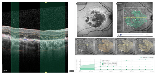 0625-601-Professions-History-of-AI-Eye-Care-InArticle1-Figure1.png
