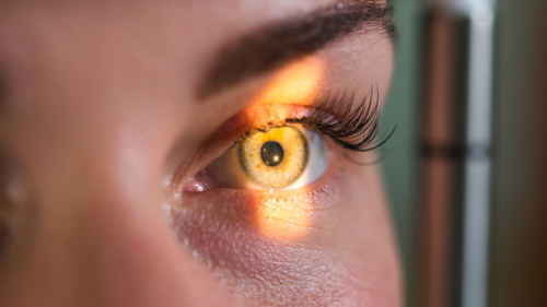 0425005-AI-news-Deep-Learning-for-Retinal-Anomalies.png