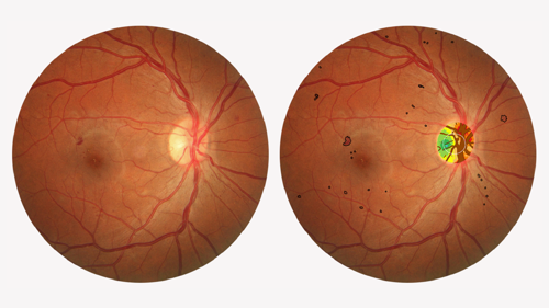 0625-601-Professions-History-of-AI-Eye-Care-InArticle1-Figure3.png