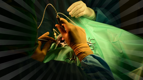 0625-205 PPV Glaucoma Risk.png