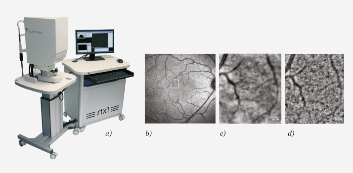 Figure 3.  (a) Imagine Eyes (b) shows a wide field fundus image from the right eye The white box indicates the area of the retina shown in panels (c) and (d)