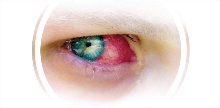 Main Teaser of an Eye for Article Bak Off
