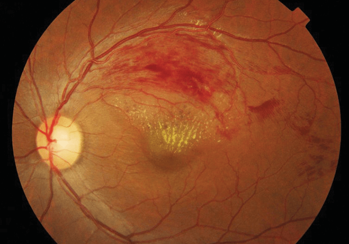 0313-403-fig.1