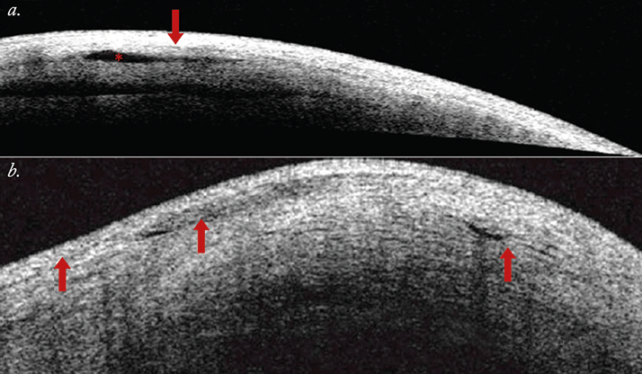 1114-401-fig1