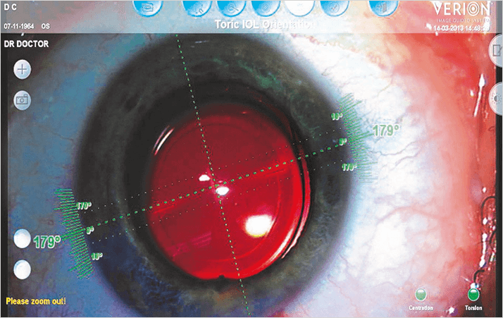 0214-401-fig.3