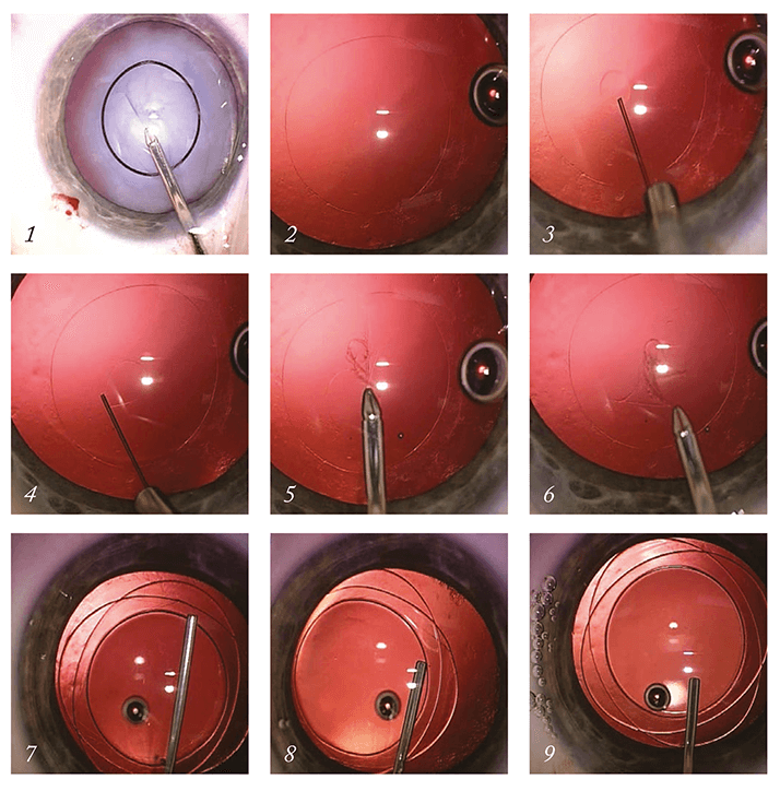 0214-402-fig.1