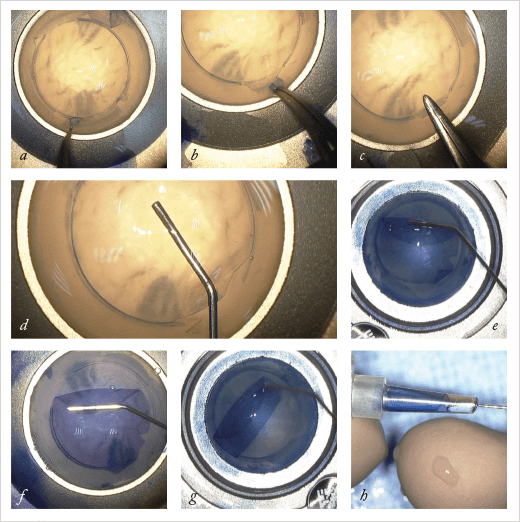0114-401-fig1