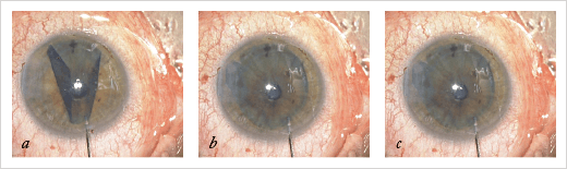 0114-401-fig3