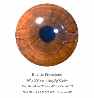 0114-403-fig2