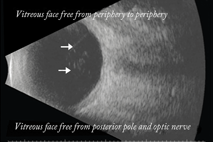 0114-502-fig4