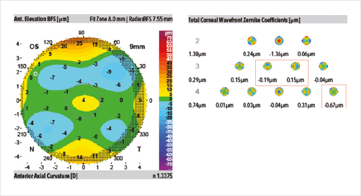 0614-502-fig.2