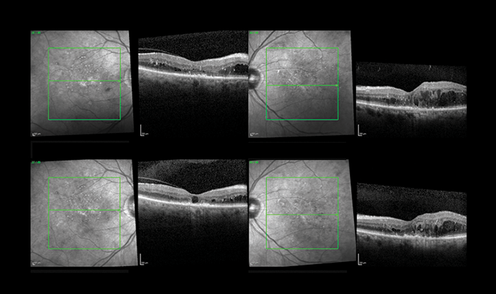 0614-601-fig.2