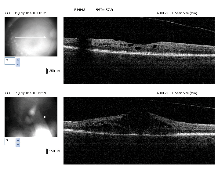 0614-604.fig1