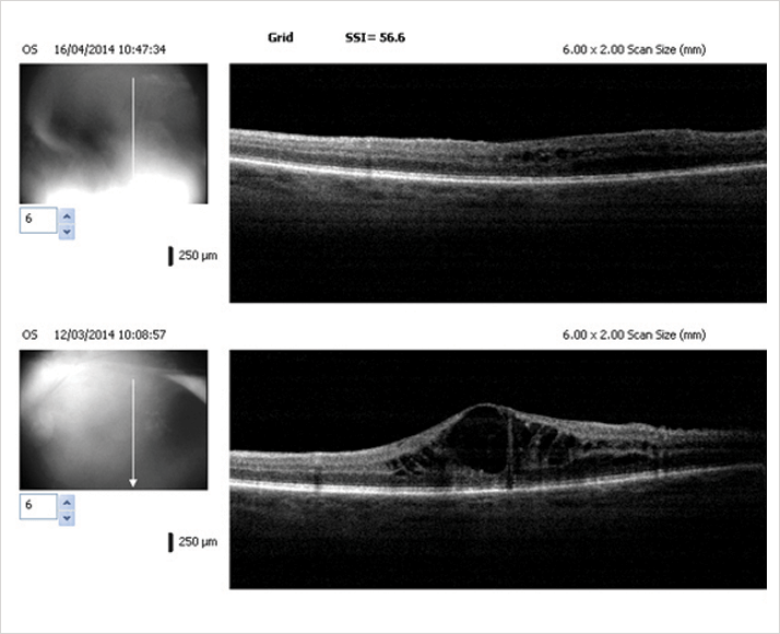 0614-604-fig2