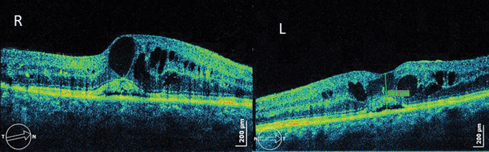 0614-605-fig.1