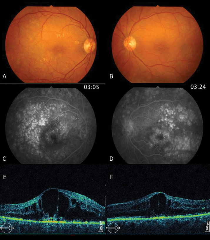 0614-605-fig.2