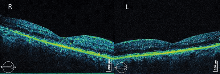 0614-605-fig.3