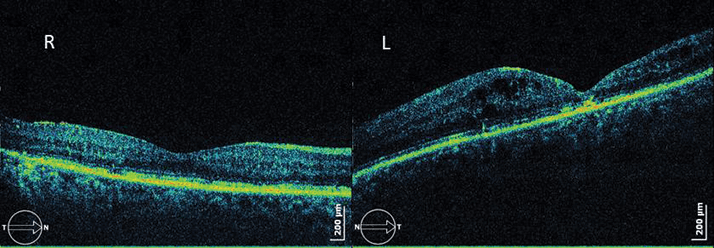 0614-605-fig.4