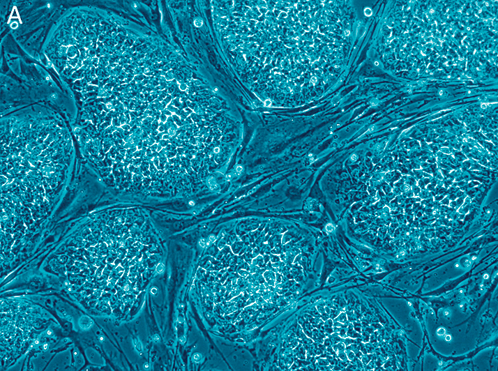 0314-205-stemcells