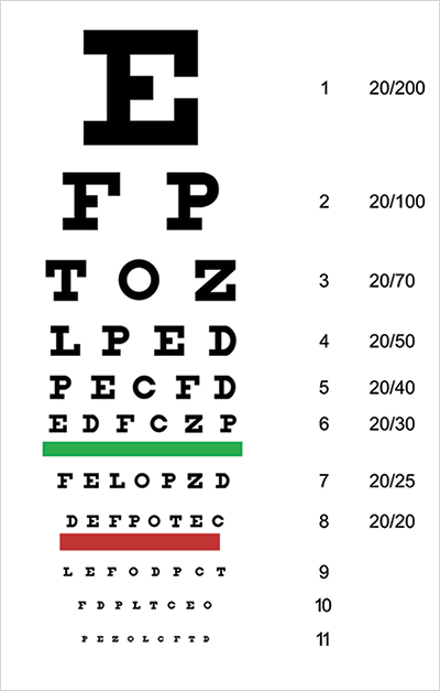 0314-401-fig.1x400