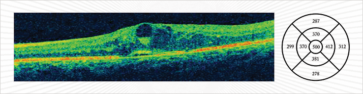 0314-403-fig.1