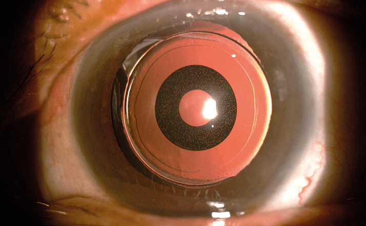 1014-401-fig.1