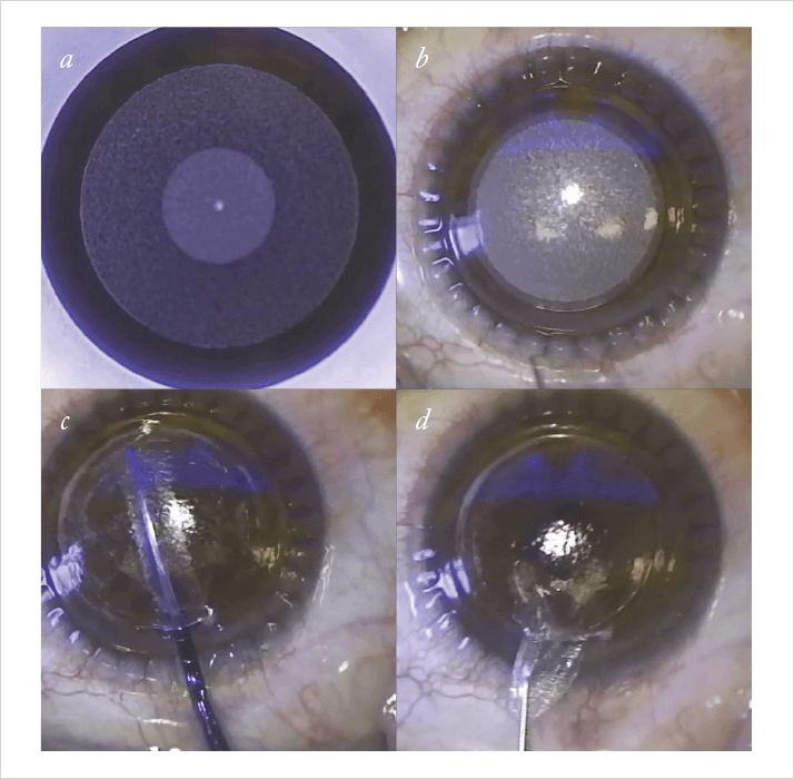 1014-403-FIG1