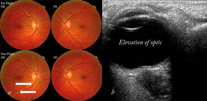 0814-401-fig.1