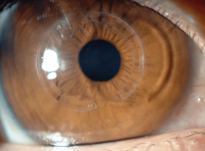 0115-403-fig1