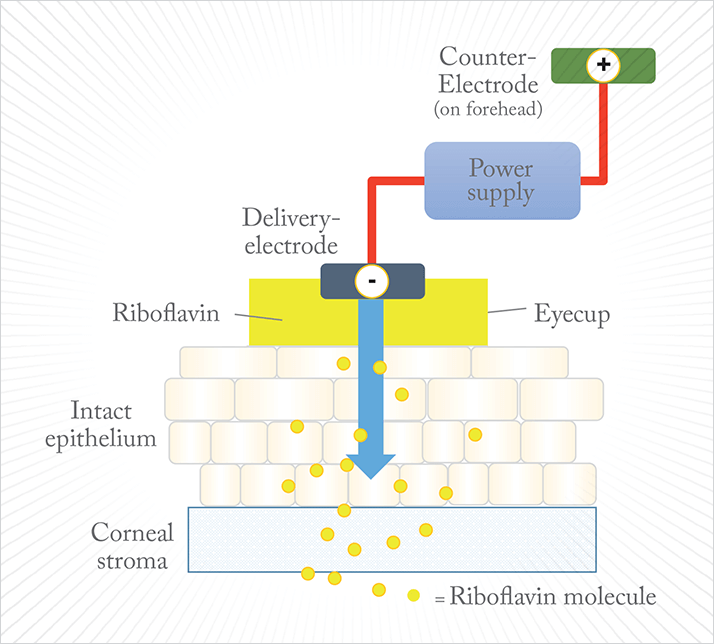 0315-401-fig6
